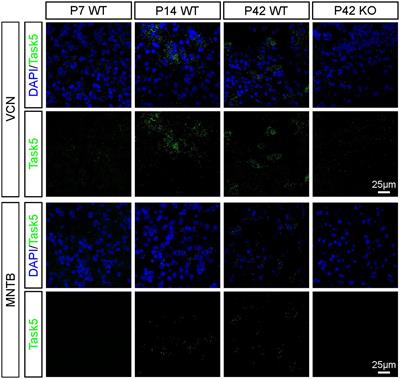 Effects of the two-pore potassium channel subunit Task5 on neuronal function and signal processing in the auditory brainstem